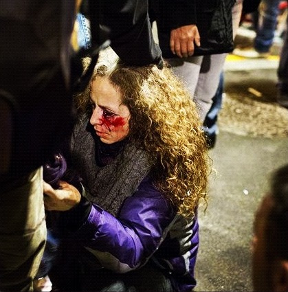 "No se dispararon balas de goma", Felip Puig, responsable de Interior de la Generalitat de Catalunya (2010-2012). En la imagen, Ester Quintana en la manifestación de la huelga general en Barcelona el 14 de noviembre de 2012 tras recibir el impacto de una bala de goma | Foto: Edu Bayer