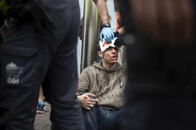 Pau Andaluz tras ser víctima de la actuación policial en Barcelona el 12 de octubre de 2012 | Foto: Robert Bonet
